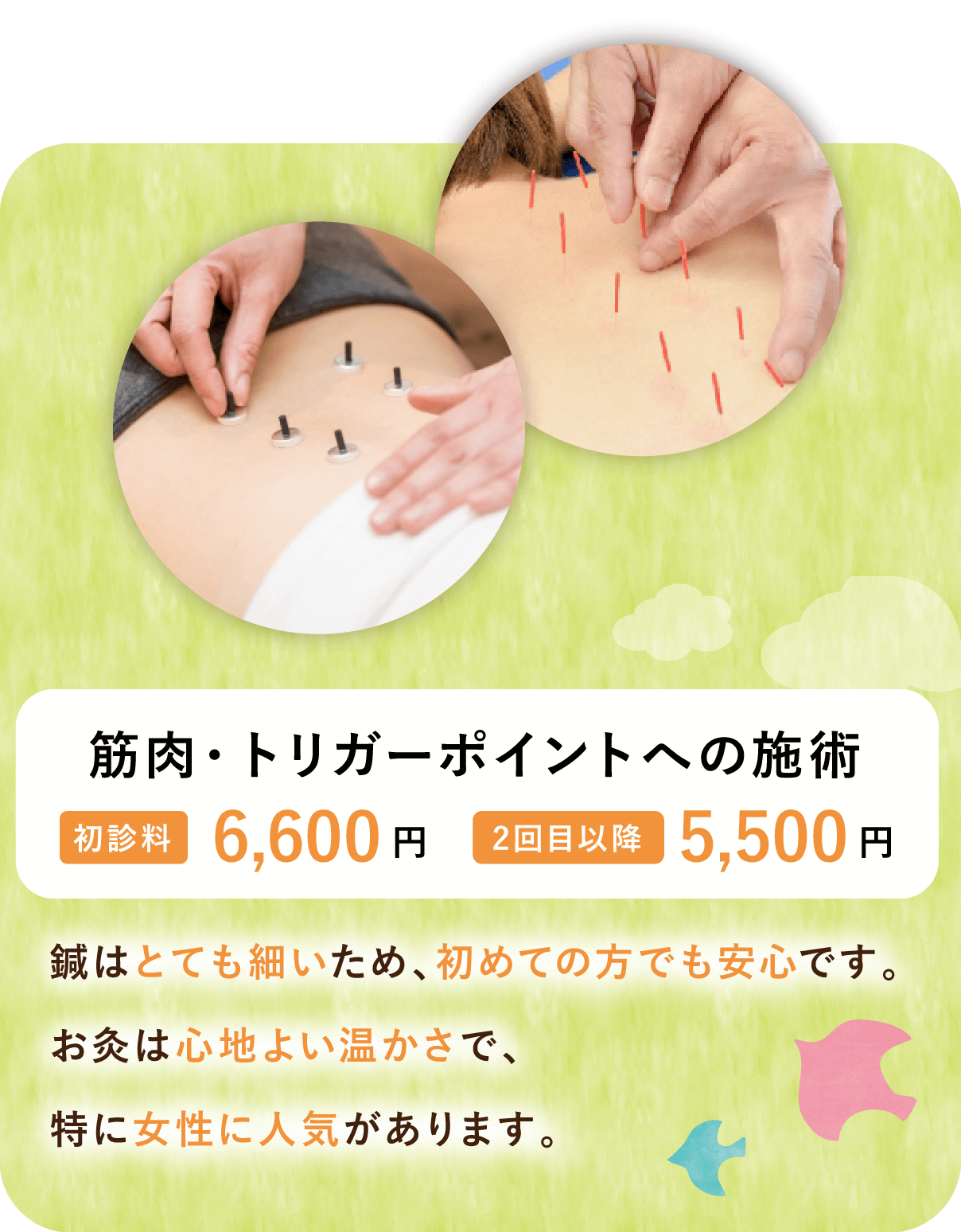 筋肉・トリガーポイントへの施術【初診料】6,600円【2回目以降】5,500円 鍼はとても細いため、初めての方でも安心です。お灸は心地よい温かさで、特に女性に人気があります。