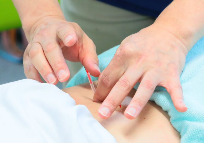 経穴(ツボ)への施術